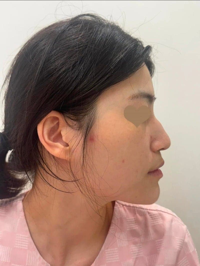 Patient review — Korean patient review #57