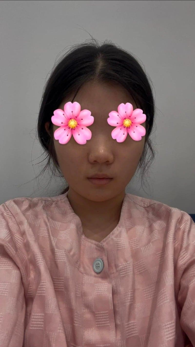 Patient review — Korean patient review #56