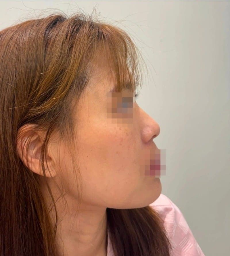 Patient review — Korean patient review #55