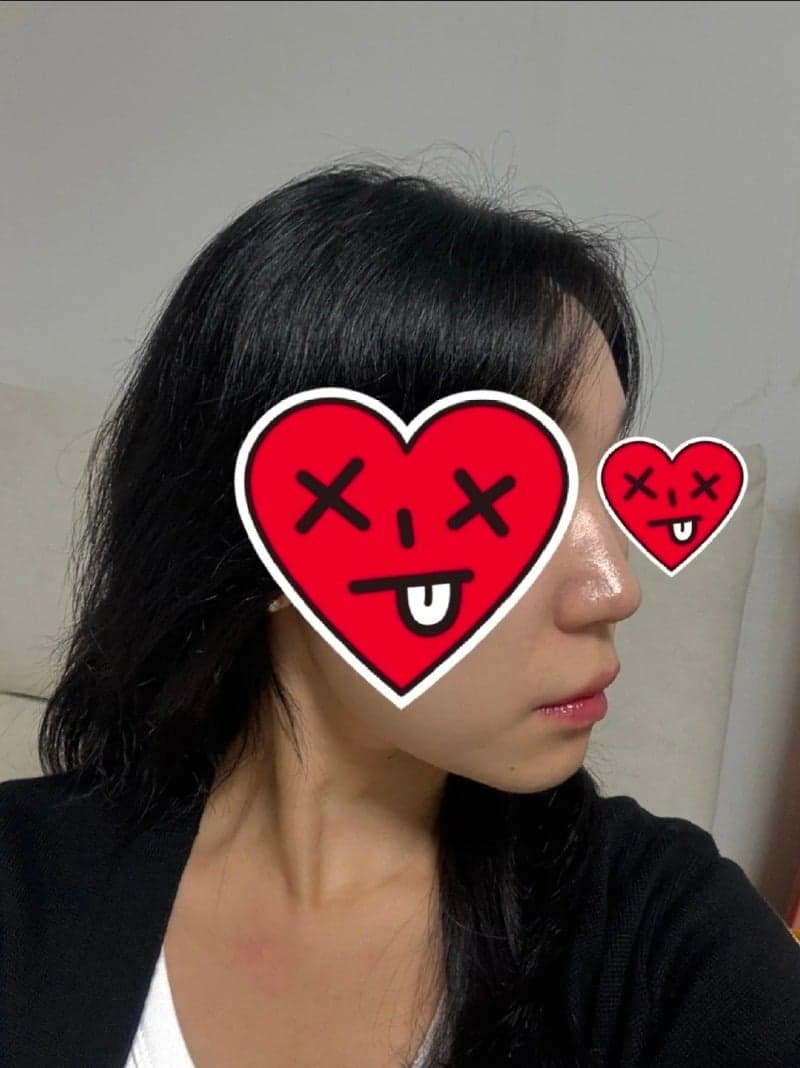 Patient review — Korean patient review #54