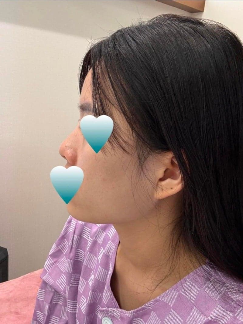 Patient review — Korean patient review #53