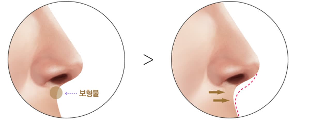 비순각 위치