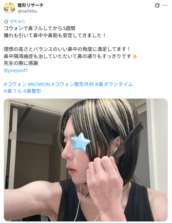 Patient review — 「理想の高さとバランスのいい鼻中の角度に満足」鼻整形3週間