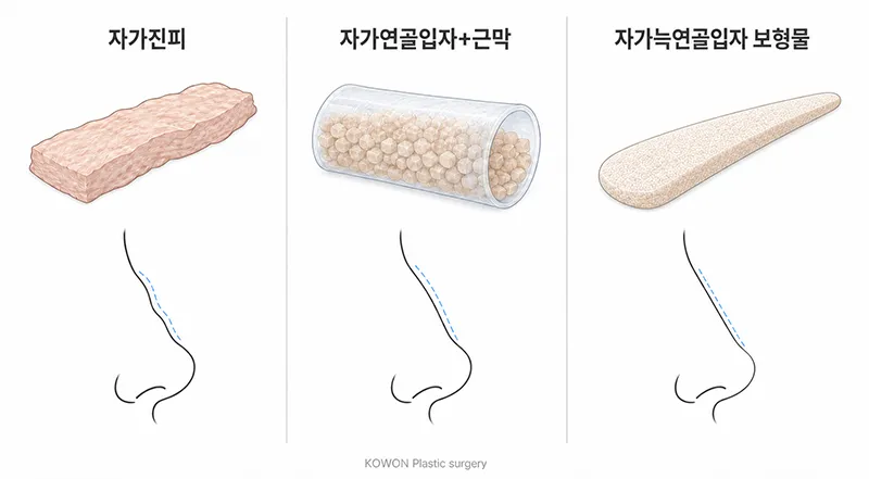 자가조직 콧대 비교 — 자가진피·자가연골입자·자가늑연골입자 보형물의 차이