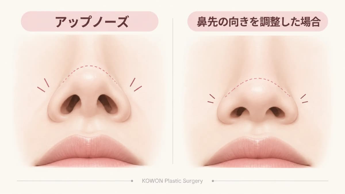 鼻先の向きと鼻の穴の見え方