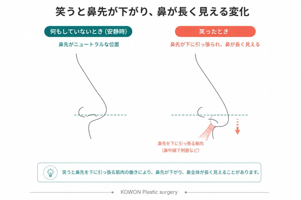 笑ったときの鼻先の変化