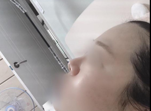 너무 이뻐요 ㅠㅠㅠ 수술후기 사진 3