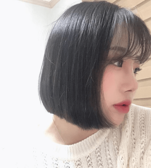 너무 이뻐요 ㅠㅠㅠ 수술후기 사진 1