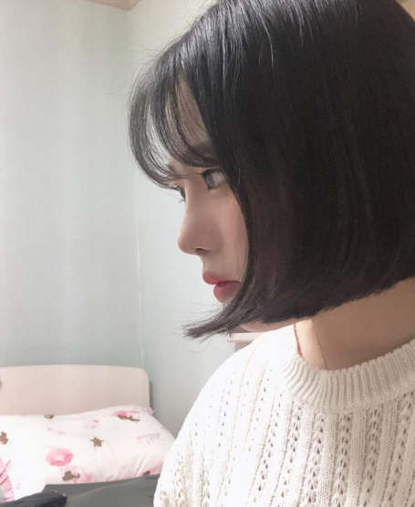 너무 이뻐요 ㅠㅠㅠ 수술후기 사진 2