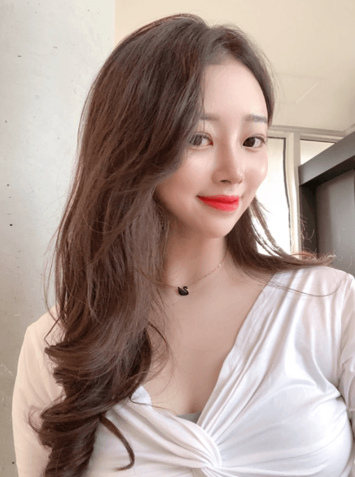 이제 딱 한달차네요!! 수술후기 사진 1