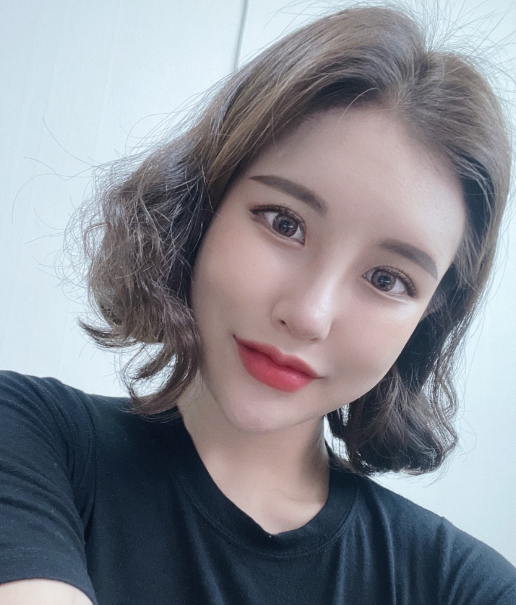 코 재수술+지방이식 너무 만족 합니다 ㅠㅠ 수술후기 사진 3