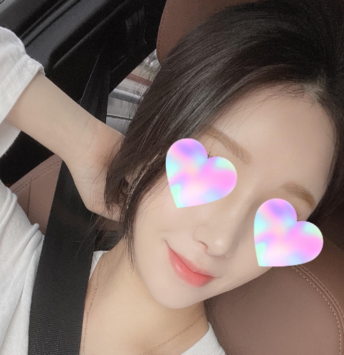 지금 너무 마음에 드는뎅! 수술후기 사진 2