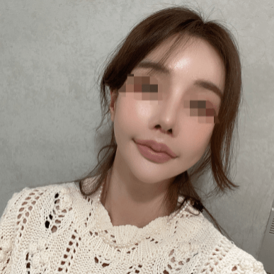 이쁘죠?? 수술후기 사진 1